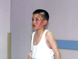 Biri kayboldu 2'si yaralandı