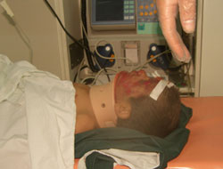 Eşek çocuğu hastanelik etti