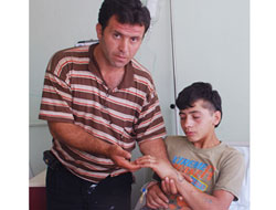 Fındık temizlerken sokan yılan hastanelik etti