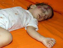 4.kattan düştü sıyrıklarla kurtuldu