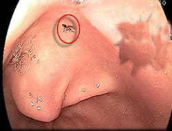 Arı soktu ama neresinden