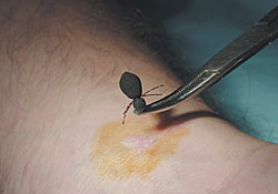 Keneye bir kurban daha