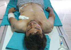 Samsun'da bıçaklı saldırı