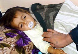 Yaz ishali ölümlere neden oluyor