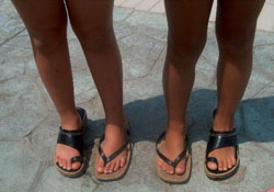 Sandaletler cilt kanser mi yapıyor?