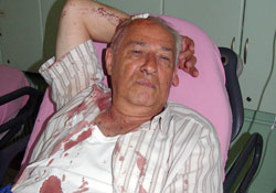 Ordu- Samsun yolunca kaza:1 yaralı