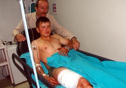 Fındık işçilerinin yol kavgası;10 yaralı