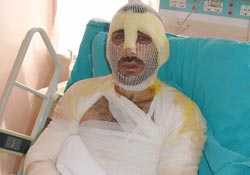 Fındık harmanı beklerken yanan araçta kaldı