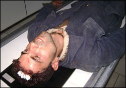 Boşluğa basınca kafasını demire çarptı