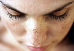 Ordulu en çok cilt kanseri oluyor