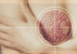 On kadından biri kanser riski taşıyor