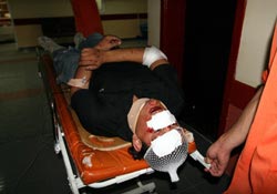 Giresun'da kaza can aldı